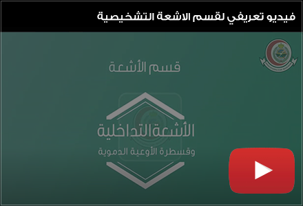 فيديو تعريفي لقسم الاشعة التشخيصية