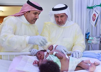 عملية فصل التوأم السيامي التنزاني 