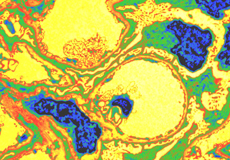 scanning  Electron Microscope image